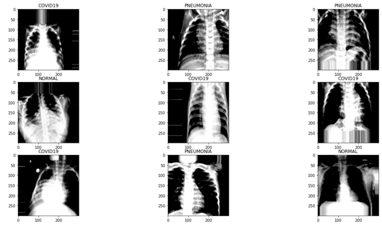 ct-scan illustration