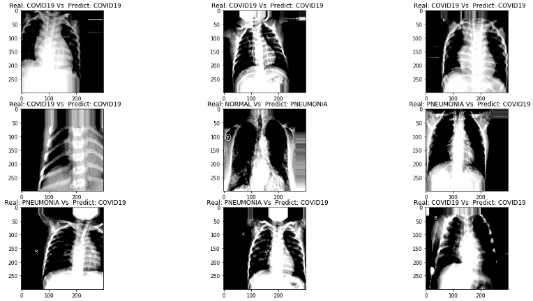 ct-scan illustration